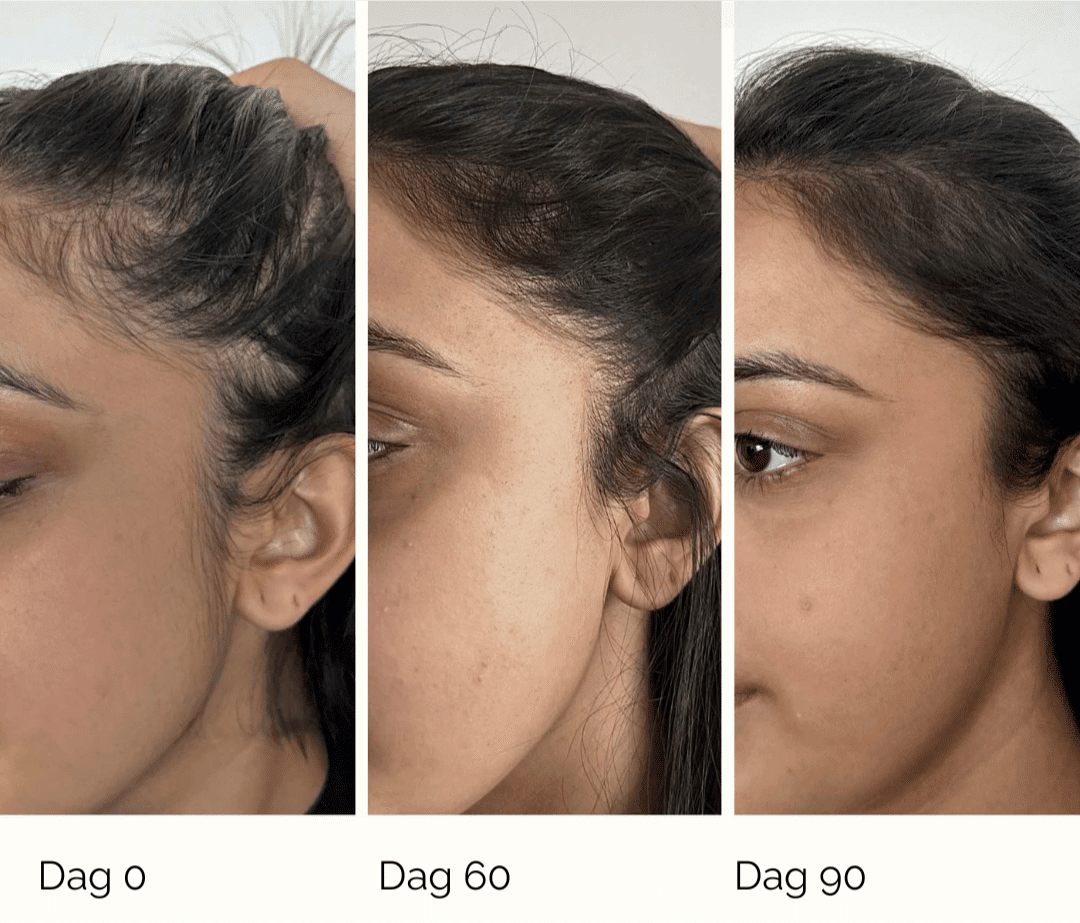 Living Proof Scalp Care density serum - Bild 3